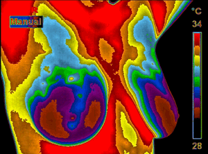 Thermogram Picture